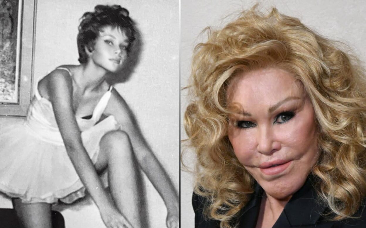 Jocelyn Wildenstein Before and After Plastic Surgery Journey