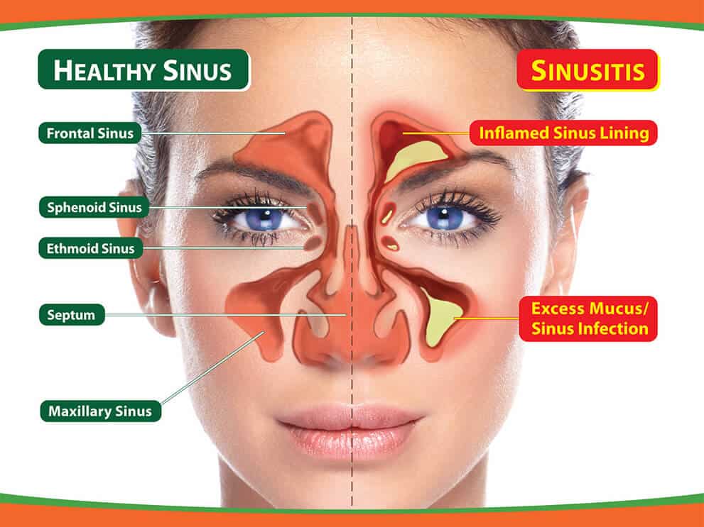 Sinus Diagram